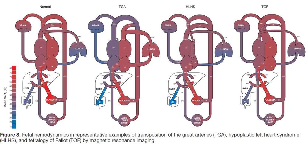 Reduced Fetal Cerebral Oxygen Consumption Is Associated With Smaller