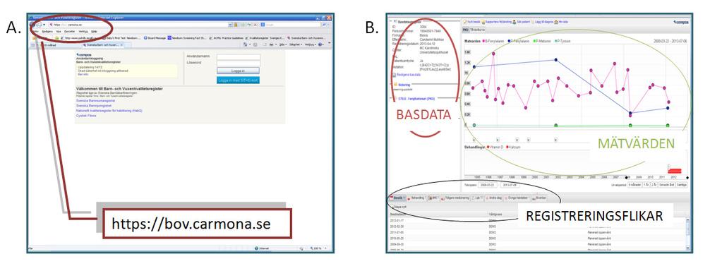 6 (11) Kvalitetsregister En separat databas som består av data från beslutsstödet, men endast för de patienter som inte motsatt sig att ingå efter att de fått muntlig och skriftig information.