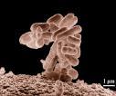(värme ca 70 grader) Jordbakterier kan bilda sporer Bildar