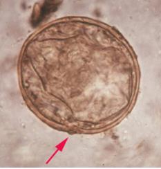 Ägg av Schistosoma