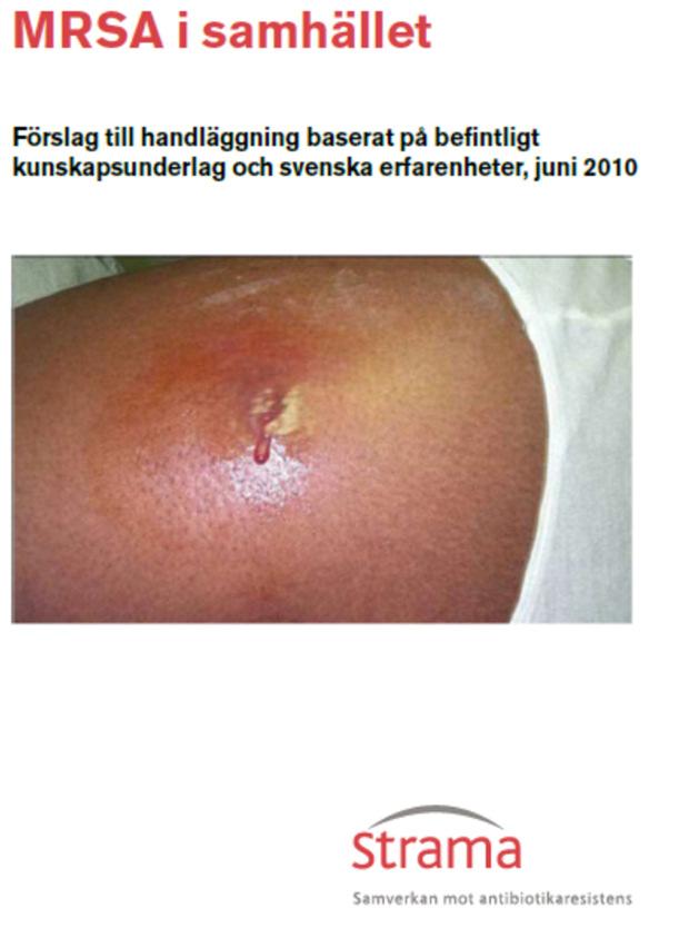 MRSA dokument MRSA i förskolan Underlag och rekommendationer för handläggning. Publicerat 2010. MRSA i samhället Publicerat 2012 MRSA hos personal inom vård och omsorg Publicerat 2007.