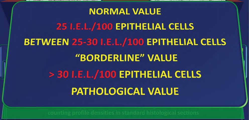 standard histological sections 40 IELs/100 epithelial cells is used as