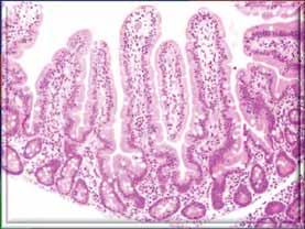 the histological