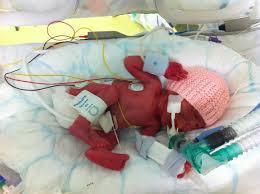 Prematur förlossning i praktiken (Karolinska) Samråd Obstetriker, Neonatolog och föräldrar Steroider har effekt redan efter 3 h FFD? Abdominellt ultraljud (sätesbjudning/tvärläge?