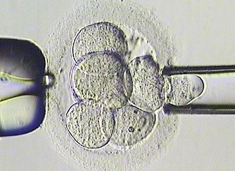 PROVTAGNING AV EMBRYON, S.K. EMBRYOBIOPSI Provtagning av embryot sker dag 3 eller dag 5-6 efter befruktningen, beroende på vilken metod som ska användas vid diagnostiken.