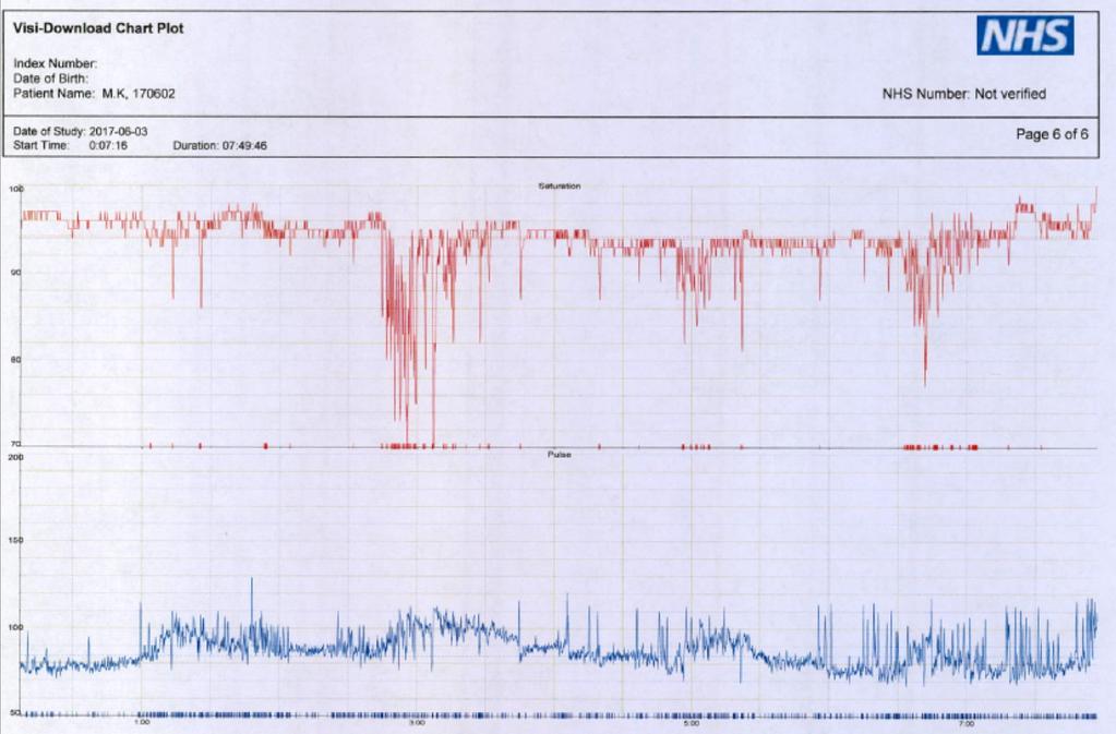 90 % Mean O2sat: 94.