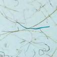 (F/m 3 ). Mikroplast Fiber Mikroskräp Övrigt antropogent Figur 3. Mikroplast, fibrer och övriga antropogena partiklar utgör tillsammans mikroskräp.