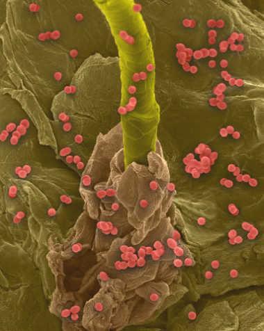 Enterokocker Streptokock som ingår i tarmens normalflora