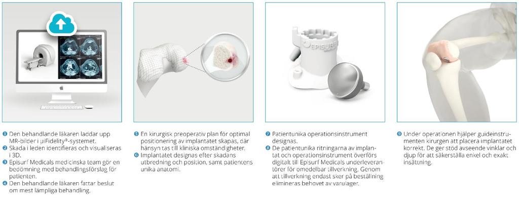 Episurf Medicals teknologi Från magnetkamerabild till skräddarsydda implantat och instrument.