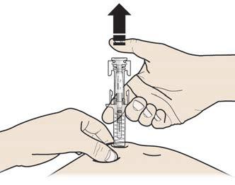 Steg 3: Injicera Fortsätt att nypa ihop A huden. STICK IN nålen i huden.