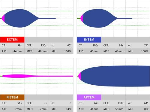 Koagulationsmonitorering med hjälp av ROTEM ger en snabb uppfattning om den globala hemostasfunktionen samt om några detaljaspekter.