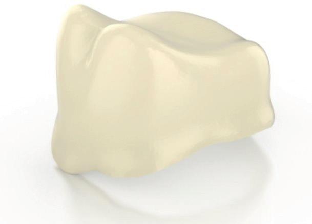 För att färga in dessa rekommenderar vi IPS e.max ZirCad LT colouring liquids. 1280 Mpa. 42 % translucens.