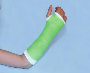 Produktsortiment inom immobilisering Syntetgips 11 3M Scotchcast Plus syntetgips i glasfiber på rulle lasfiber har sedan de ennier tillbaka arit basmaterial i det h rda s ntetiska ipset S ot h ast l