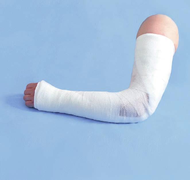 Produktsortiment inom immobilisering Skenor 7 3M Scotchcast Conformable Roll Splint (CRS) ensidigt polstrad