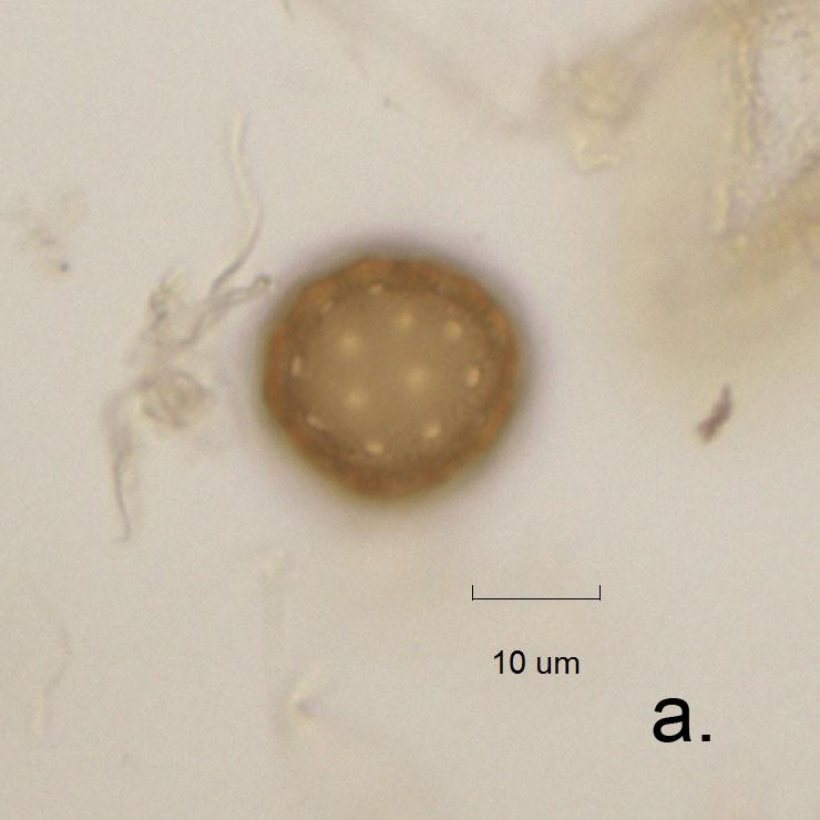 Figur 15. Ett Chenopodiaceae-pollen visas i a och b. Pollenkornet är taget i olika fokus (Foto: Christine Åkesson 2011). Figur 16. Runda, svartgröna partiklar upptäcka i prov 8.