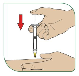 4 - Om möjligt, nyp försiktigt ihop huden runt det desinficerade injektionsstället (för att lyfta upp det lite). 5 - Håll sprutan som en penna eller en pil.