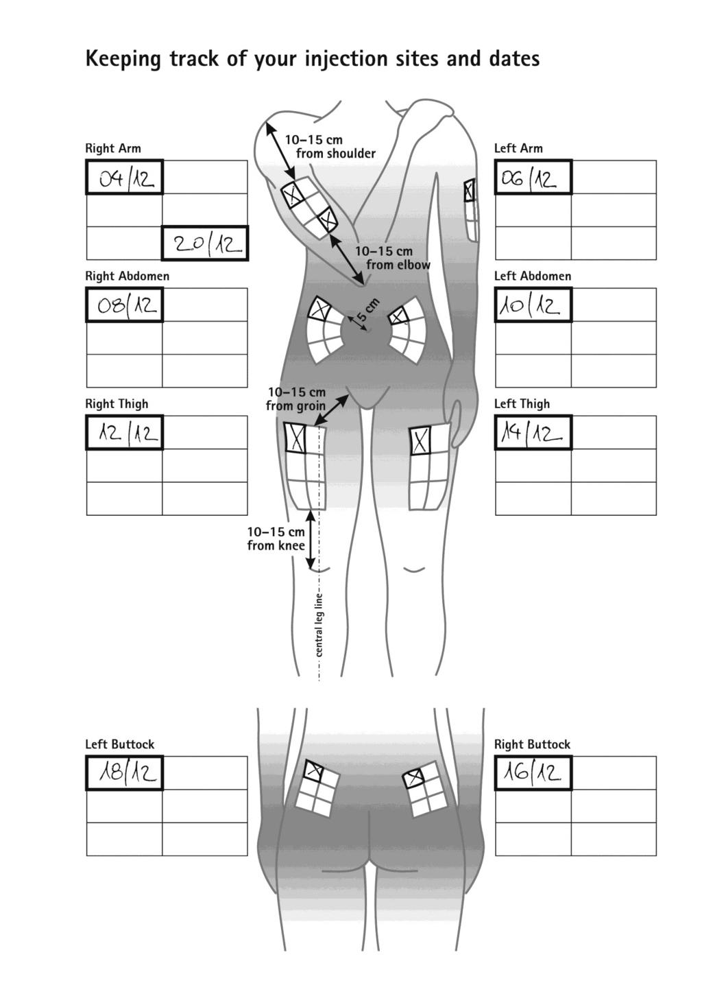 EXAMPEL PÅ BEHANDLINGSKALENDER: HÅLLA ORDNING PÅ INJEKTIONSSTÄLLEN OCH DATUM Höger arm 10-15 cm från axeln Vänster arm Höger sida av buken 10-15 cm