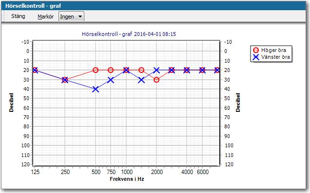 Hörselkontroll Datum visas i graf Nu visas datum i grafen av resultatet från en hörselkontroll. Datumet visas i uppe i rubriken för grafen.