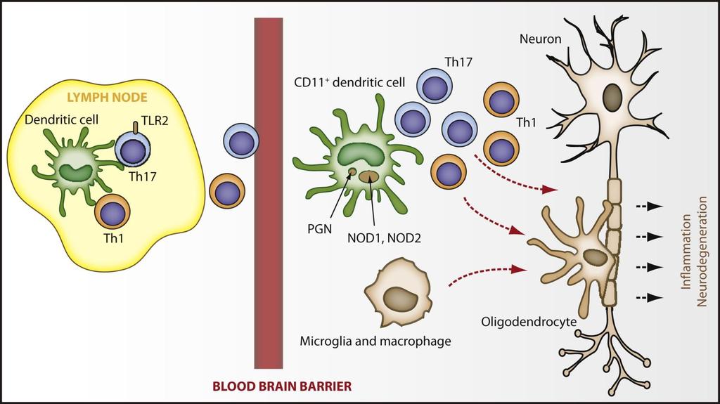 Multiple sclerosis: autoimmune disease