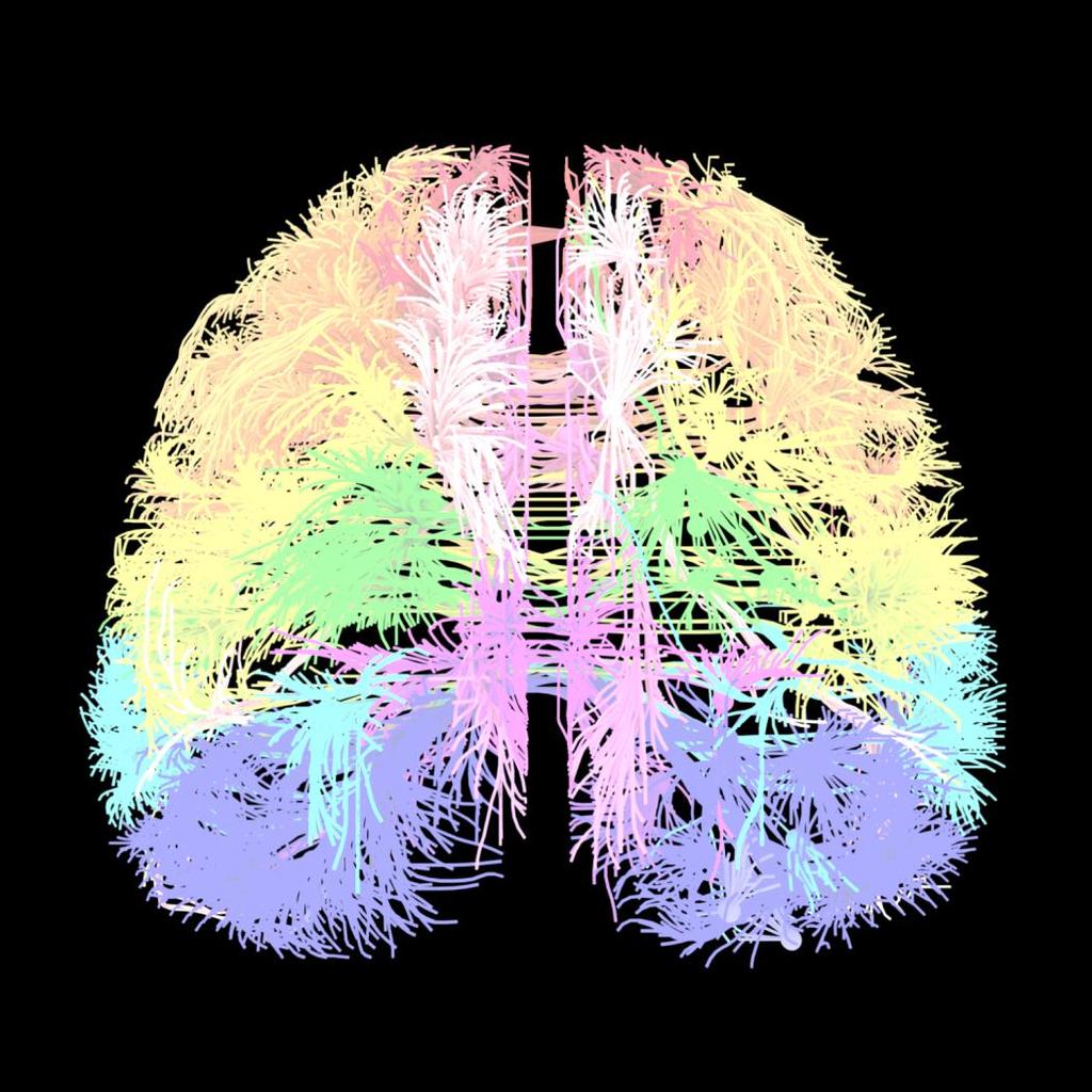 Psykosociala faktorer Smärtupplevelse / Smärtbeteende NEUROMATRIX Endokrin, immunologisk och autonom