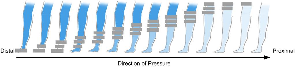 Lympha Press Optimal V2 Lympha Gradient Program I det Graderade Lymfdränageprogrammet fylls manschetterna på samma sätt som vid användning av Lymfdränageprogrammet, men trycket är graderat för varje