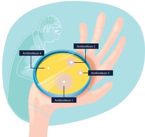 4.2 Egen Staph. aureus del 4 Antibiotikaresistensbestämning & Avläsning Koagulastest Antibiotikaresistensbestämning Materiel Egen S. aureus (från lab 2.