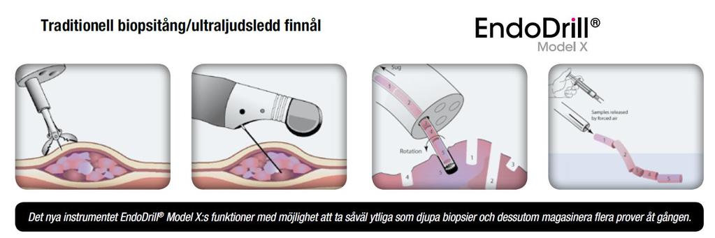 EndoDrill Model X EndoDrill Model X är ett biopsiinstrument med unika funktioner som på sikt kan ersätta en stor andel av dagens biopsitänger och nålar för flera indikationer inom flexibel endoskopi.