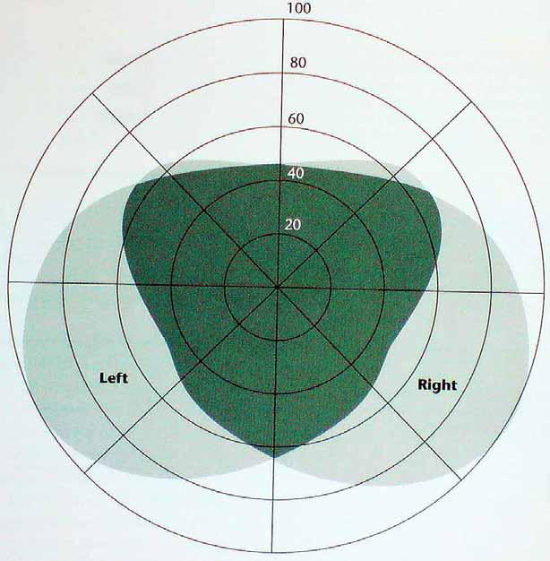 Ware, Colin (2004) Information Visualization.