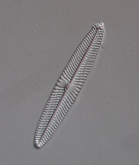 Figur 7. De näringskrävande arterna Navicula escambia och Navicula germainii, Medins Biologi AB.