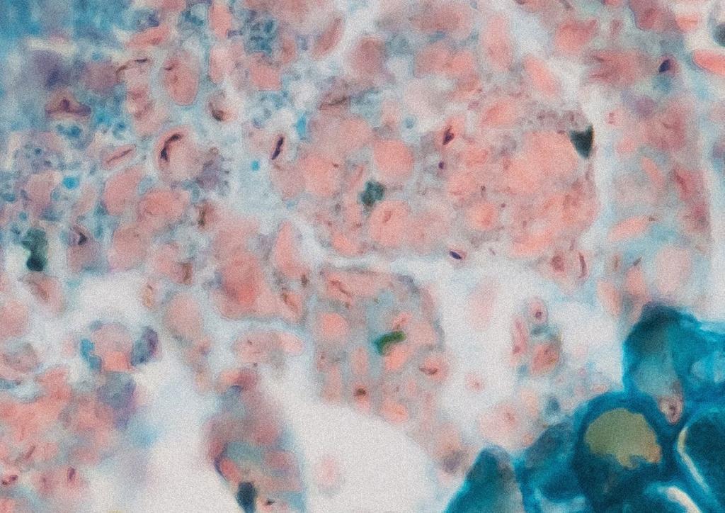 Historik Lumito har sina rötter i forskningen vid Medicinskt lasercentrum vid Lunds universitet.