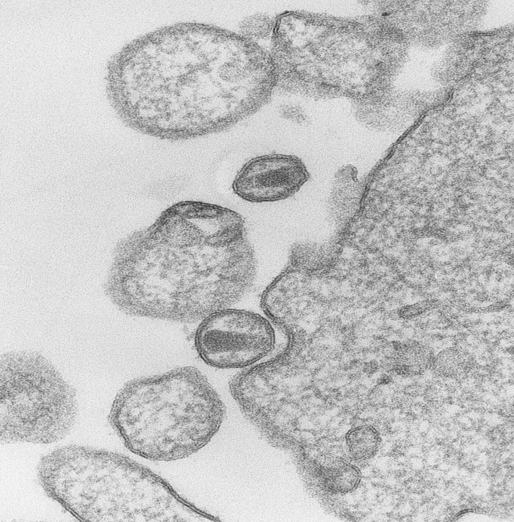 HIV virus knoppas av från cell