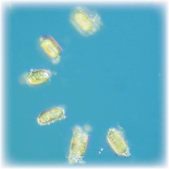 The Baltic Sea Arkona Basin BY2 19 th of March Small colony forming cyanobacteria were the most abundant.