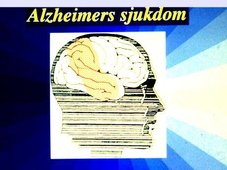 Dominerande demensformer Alzheimer Vaskulär demens Pannlobsdemens Övriga LBD (med Park/AD) 50% 20 25% 8 20% 10% 8-14% Åldrandets nedgång och summationsdemens?