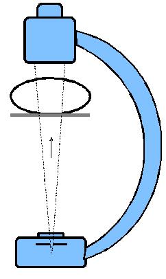 KAP/DAP (Kerma-Area-Produkt eller