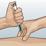 Injektionsområden: Direkt-/snabbverkande insulin: buk Mixinsulin: buk eller lår Basinsulin: lår eller skinka i första hand Injektionerna skall spridas inom injektionsområdet, minst 2 cm från