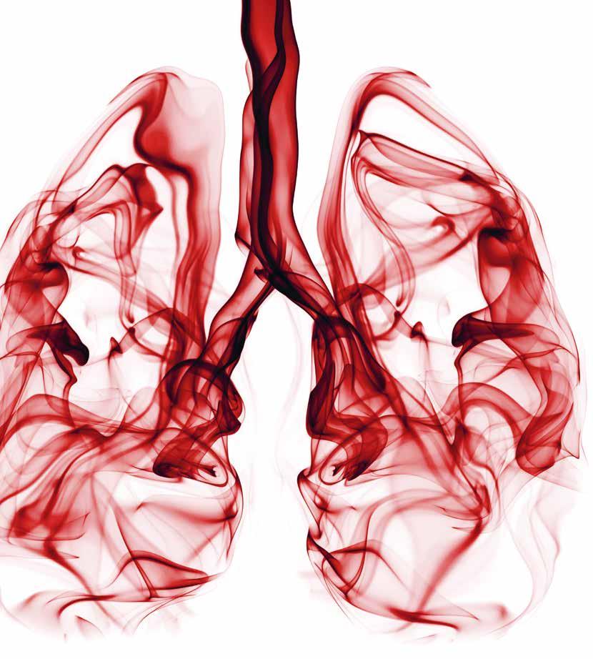 Finna bättre metoder för tidig upptäckt av lungsjukdom Utveckla bättre behandlingar Kartlägga de olika undergrupperna av