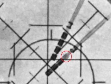 Referensexem pel på en överensstäm mande mest proximal osegmentera d elektrod Referensexemp el på en ickeöverensstämm ande mest proximal osegmenterad elektrod Figur 3: Fluoroskopisk lateral