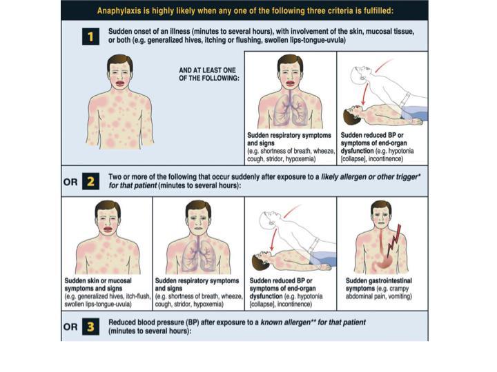 Vad är anafylaxi? Anafylaxi en akut, svår, oftast snabbt insättande systemisk överkänslighetsreaktion med objektiv påverkan från flera organsystem som är potentiellt livshotande.
