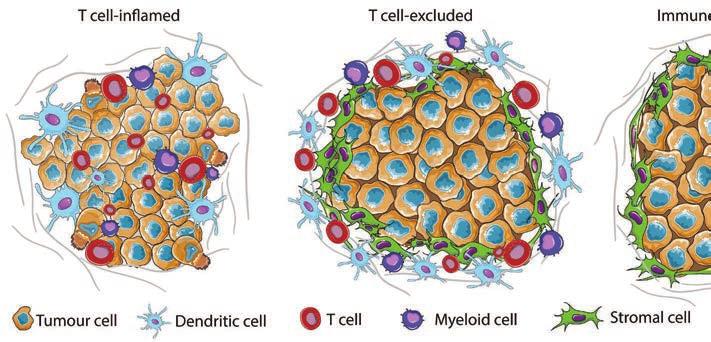 Figur 1. Tumörer kan delas in i tre klasser beroende på graden av T-cellsinfiltration. Vänstra panelen visar en T-cellsinflammerad tumör, vilket benämns immunologiskt het tumör.