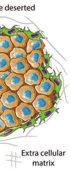 Mittpanelen och den högra panelens benämns immunologiskt kalla tumörer.
