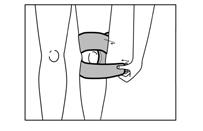 DANSK Læs disse instruktioner nøje inden anvendelse! DANSK Anvendelsesområde/Indikationer Dette produkt er beregnet til at give stabilitet til patella (knæskallen).