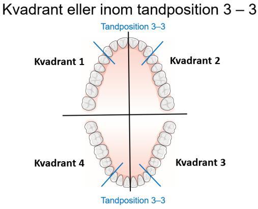 opereras för parodontit respektive periimplantit. Det är endast det totala antalet operationer som kan följas.