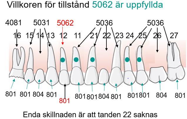 finns tandluckor eller andra tillstånd för enskilda tänder. Det skulle likna tillämpningen för tillstånd 5036 och 5037 för en- eller tvåtandlucka där ändstödet är bräckligt.