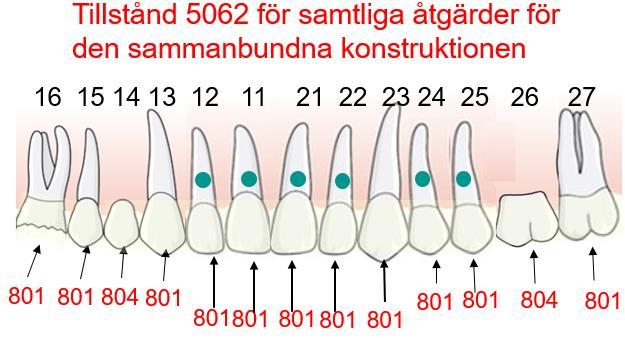 Se samma patientexempel med detta alternativ för rapportering: För att ytterligare tydliggöra tillämpningen kan patientexempel tillföras i handboken om statligt tandvårdsstöd. 3.