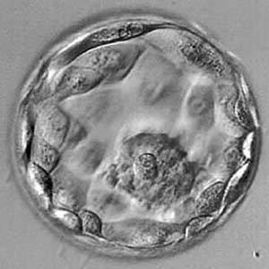 oocytvitrifiering, men äggen befruktas Embryon kan