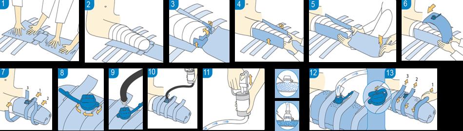 Applicera pumpslangen eller använd sugen på rummet och sug ut luften. På detta sätt erhålls en fortsatt optimal passform. Se till att knäled är fullt extenderad i samband med att luften sugs ut.