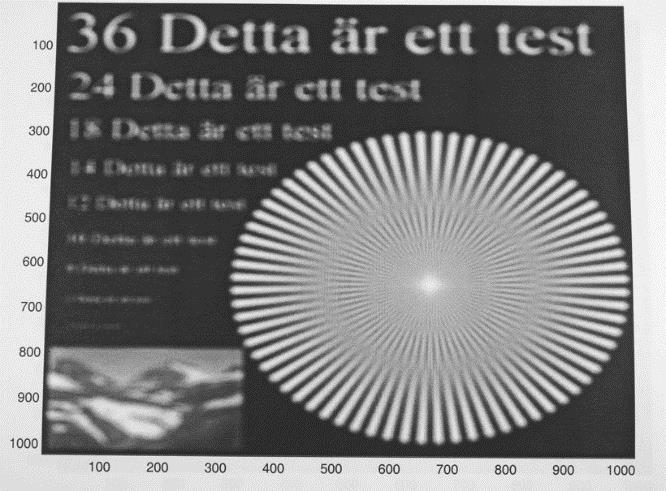 185 Fig. 17.32. Vänstra figuren visar en bild som erhållits då optiken varit felfokuserad.
