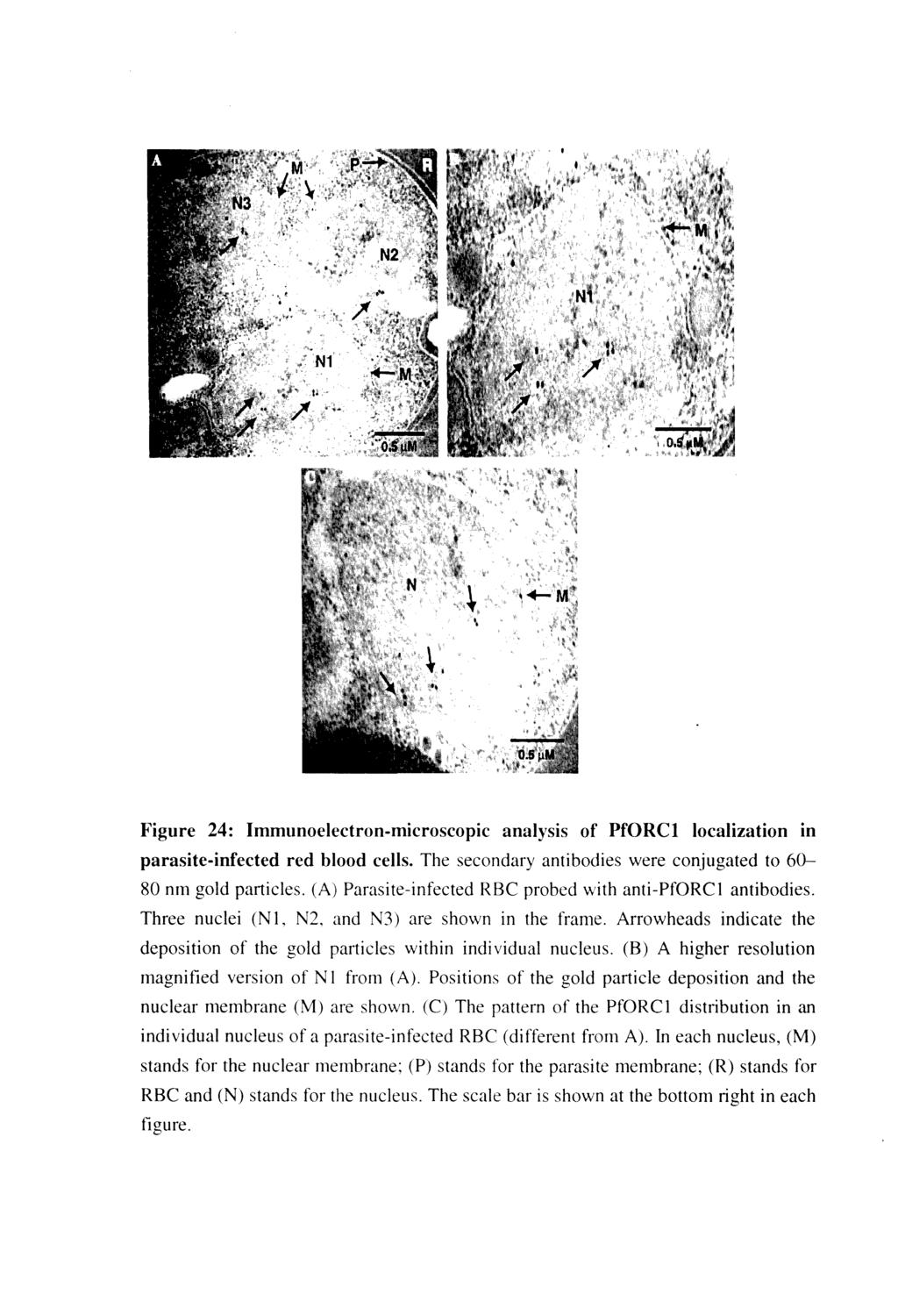 Figure 24: Immllnoelectron-microscopic analysis of PfORCl localization in parasite-infected red blood cells. The secondary antibodies were conjugated to 60-80 nm gold particles.