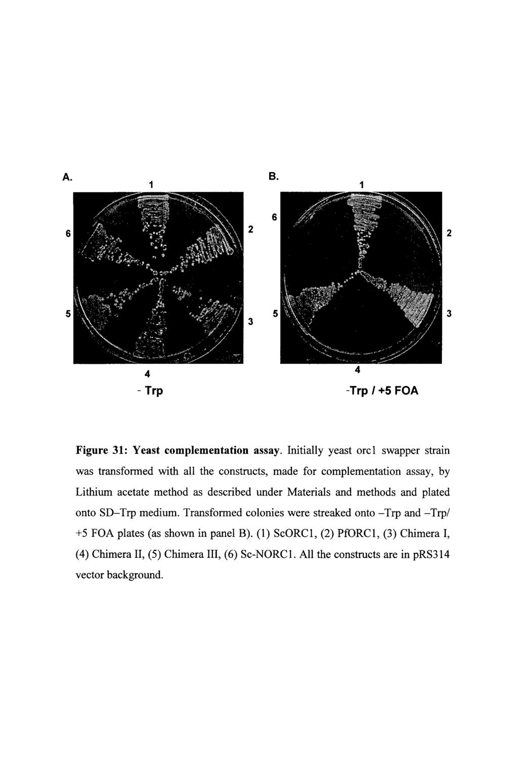 A. B. 1 1 6 6 2 2 5 3 5 3 4 - Trp -Trp 1+5 FOA 4 Figure 31: Yeast complementation assay.