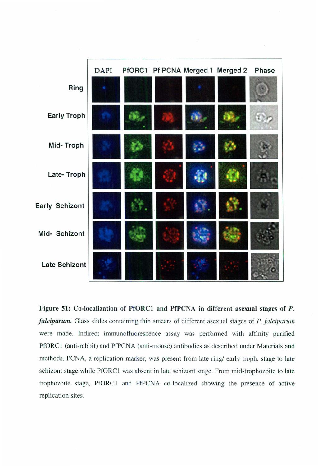 DAPI PfORC1 Pf PCNA Merged 1 Merged 2 Phase Ring Early Troph Mid- Troph Late- Troph Early Schizont Mid- Schizont Late Schizont Figure 51: Co-localization of PfORCI and PfPCNA in different asexual